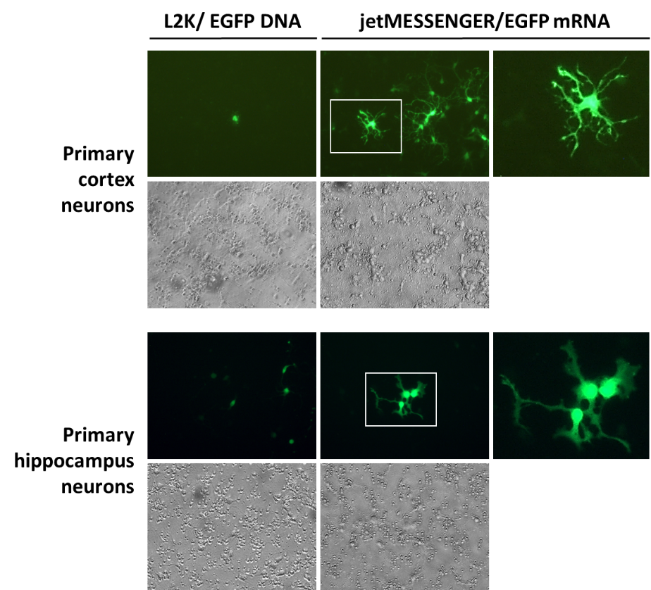 jetMESSENGER provides higher transfection efficiency, better cell viability and is respectful of neuronal cell morphology. 