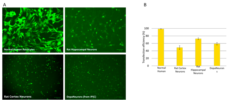 Transfection of different type of neurons using jetMESSENGER®